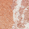SODA0005F