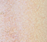 SODA0062F