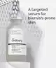 The Ordinary - The Spot Support Set