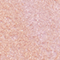 TOOF0159F
