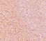 TOOF0159F