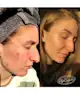 UpCircle Beauty - Face Toner with Hyaluronic Acid